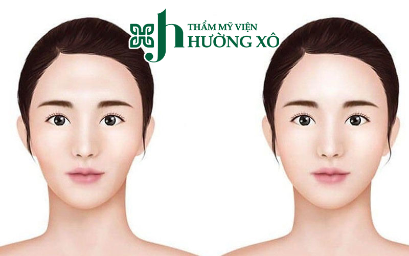 Dịch Vụ Tiêm Má Baby Uy Tín Tại Hà Tĩnh