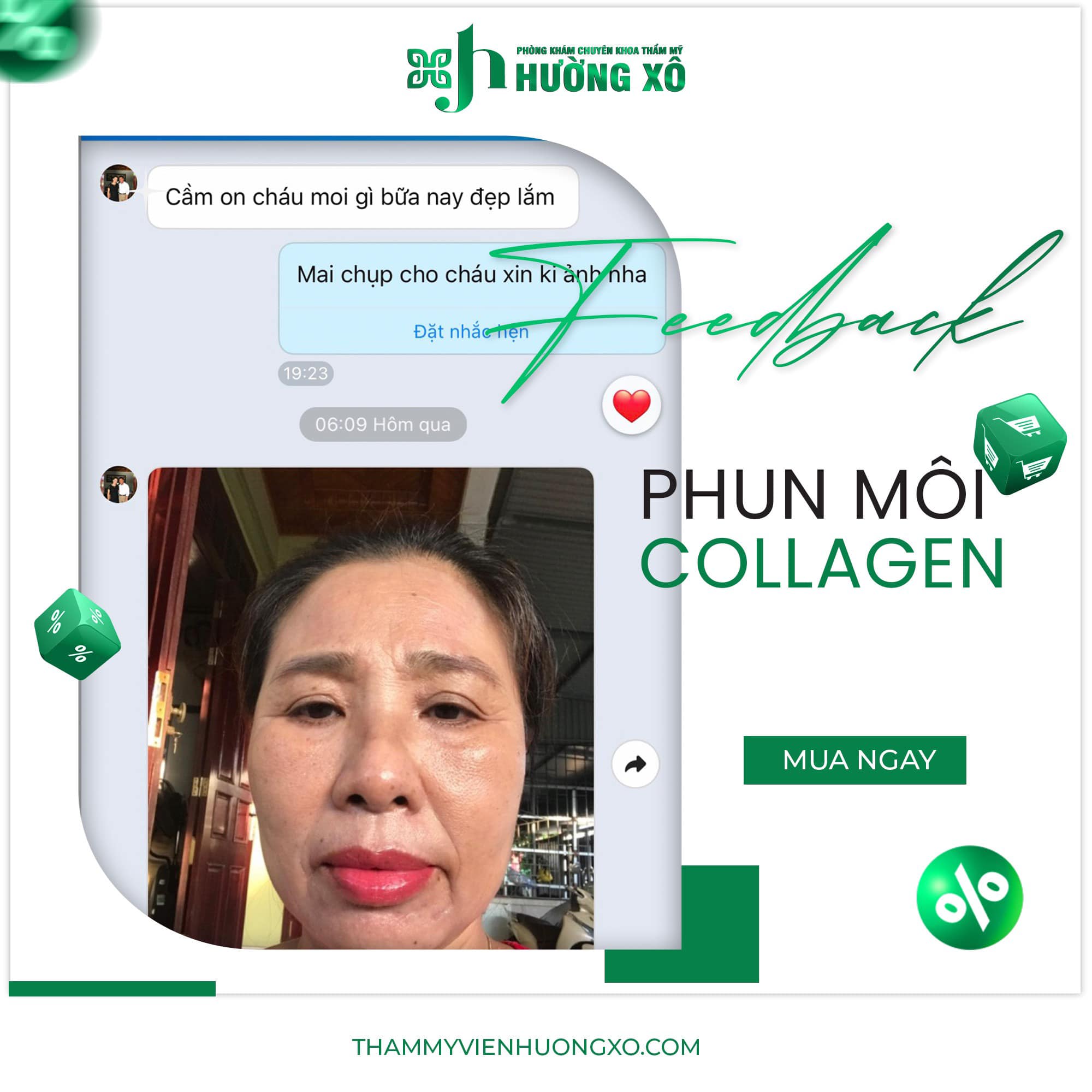 Địa Chỉ Phun Môi Collagen Uy Tín Tại Vinh