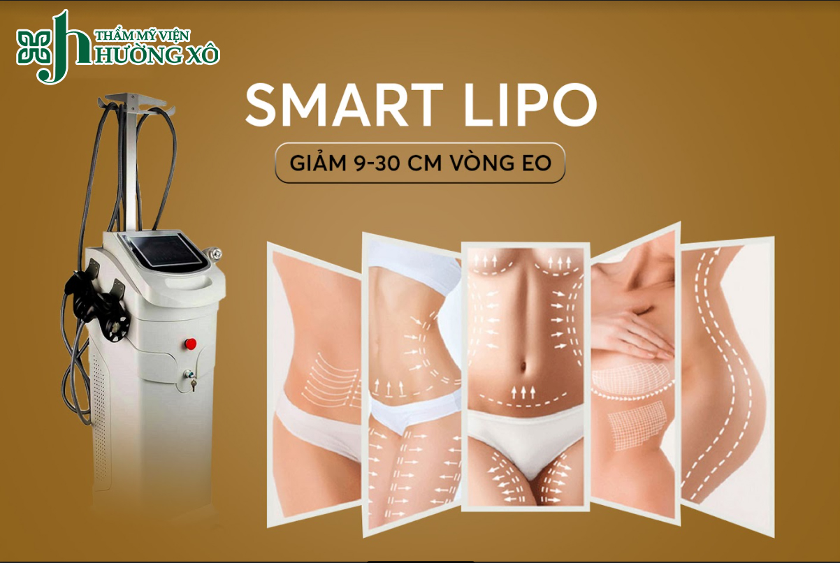 Dịch Vụ Giảm Béo Smart Lipo Uy Tín Tại Vinh
