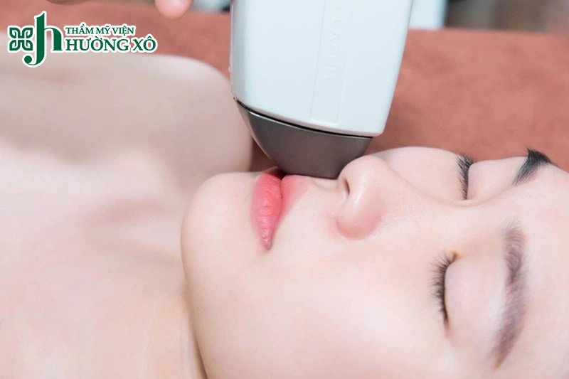 Dịch Vụ Triệt Lông Mép Công Nghệ Laser Diode Tại Vinh