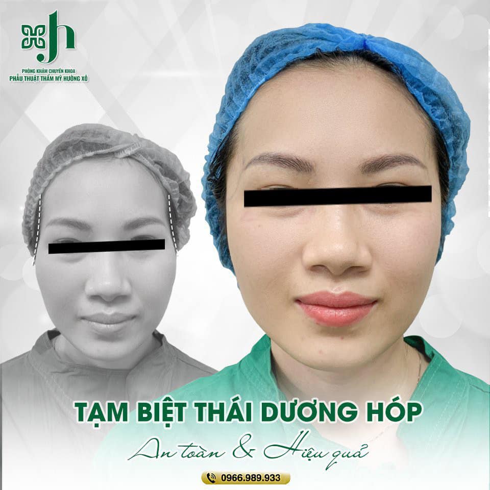 Độn Thái Dương Ở Đâu Uy Tín Tại Vinh?