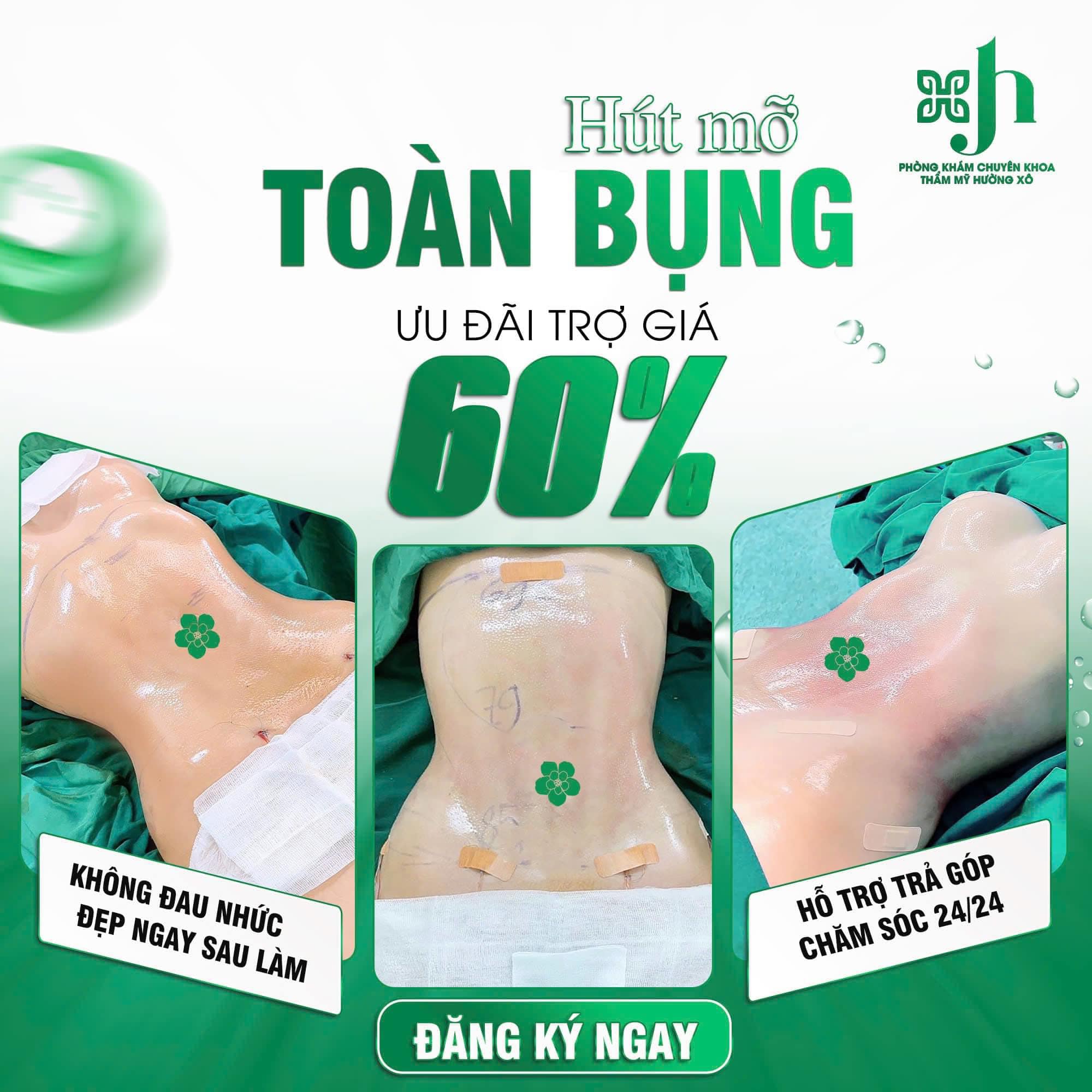 Địa Chỉ Hút Mỡ Bụng Uy Tín Tại Vinh