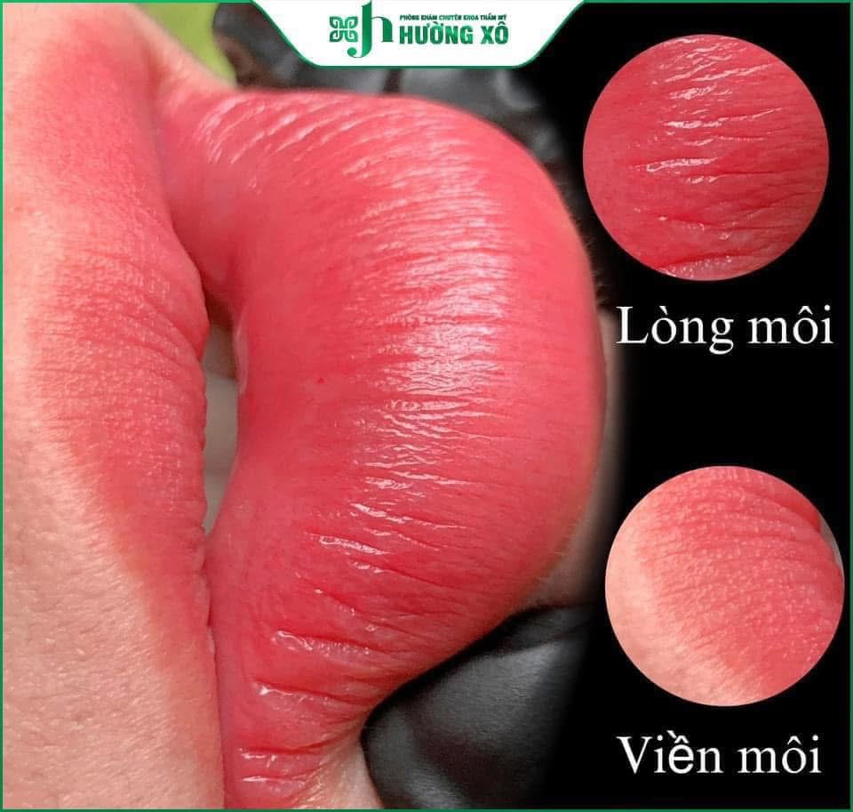 Địa Chỉ Phun Xăm Môi Uy Tín Tại Vinh