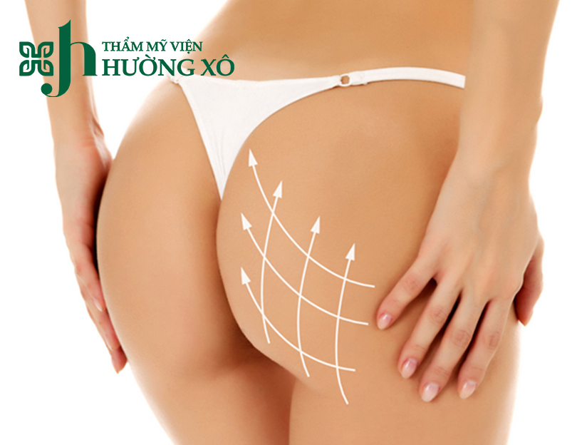 Cung Cấp Dịch Vụ Độn Mông Uy Tín Tại Vinh