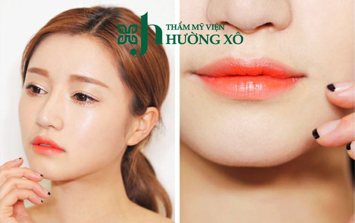 Địa Chỉ Thu Gọn Môi Dày Uy Tín Tại Vinh