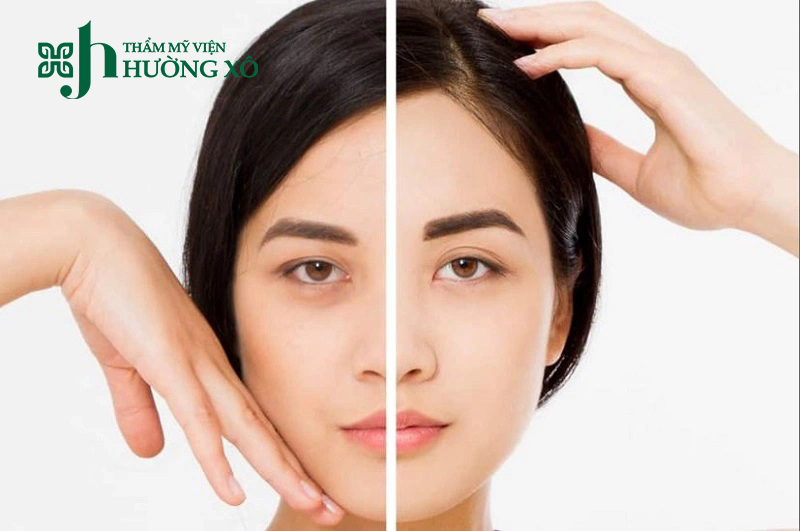 Tư Vấn Dịch Vụ Nâng Cung Mày Uy Tín Tại Vinh