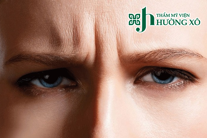 Dịch Vụ Xoá Nhăn Cau Mày Uy Tín Tại Hà Tĩnh