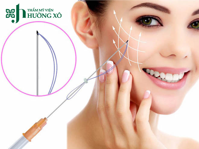 Trung Tâm Căng Chỉ Collagen Uy Tín Tại Vinh, Nghệ An