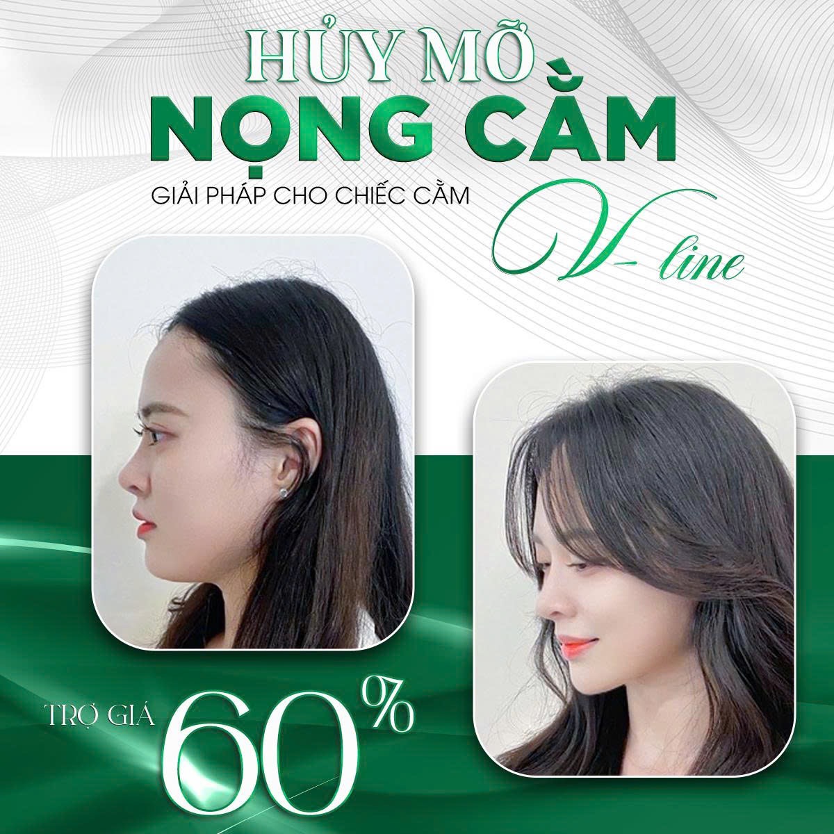 Địa Chỉ Tiêm Tan Nọng Cằm Uy Tín Tại Hà Tĩnh