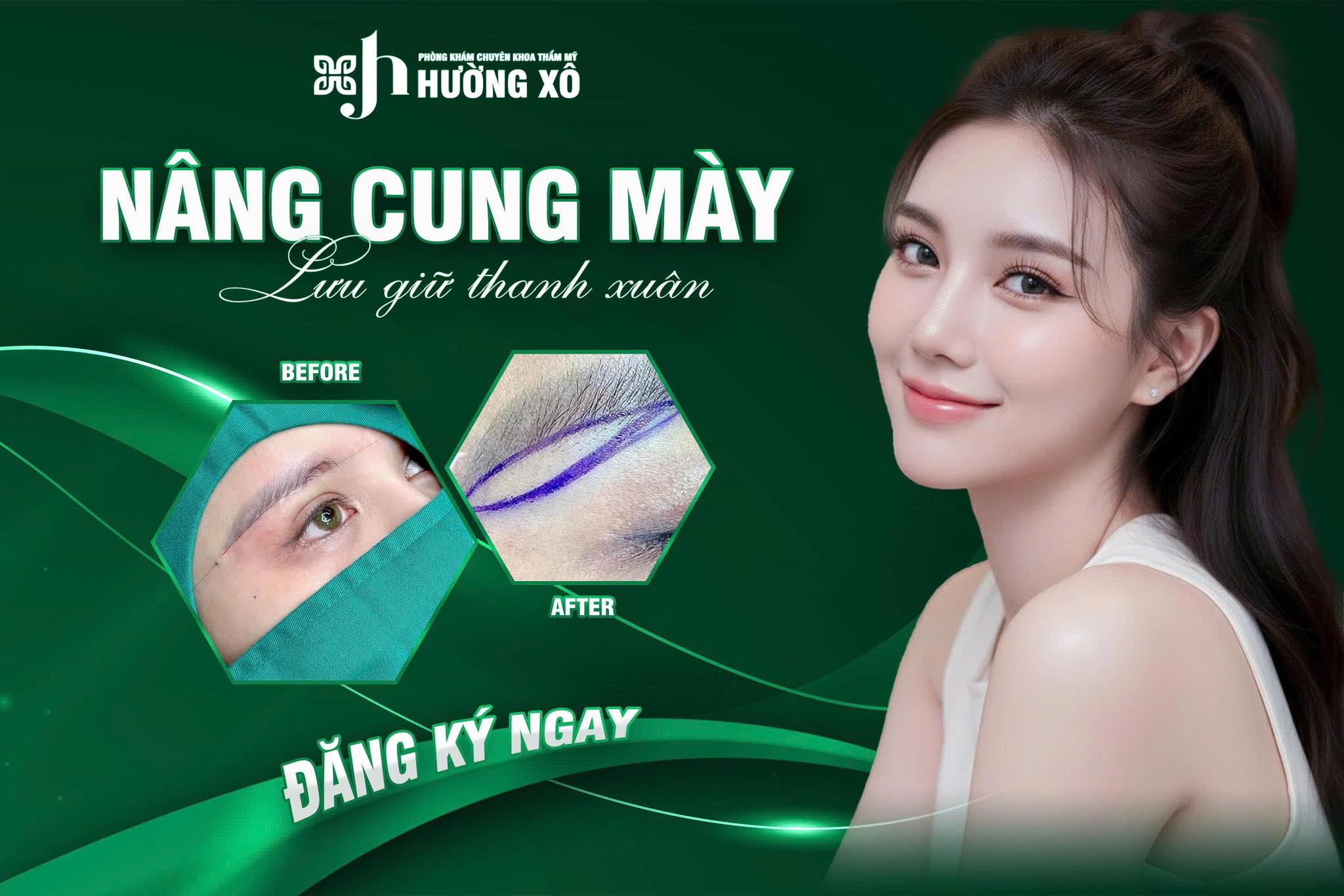 Dịch Vụ Nâng Cung Mày Uy Tín Tại Vinh, Nghệ An