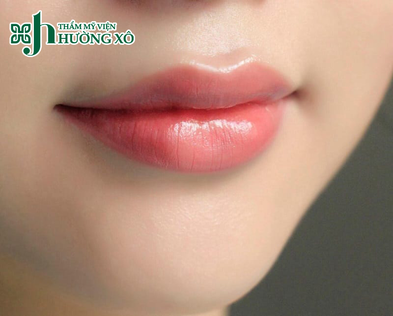 Dịch Vụ Thu Gọn Môi Dày Uy Tín Tại Vinh, Nghệ An