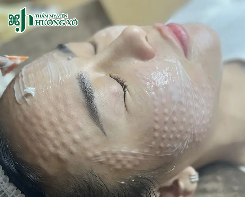 Dịch Vụ Tiêm Meso Căng Bóng Da Tại Vinh, Nghệ An