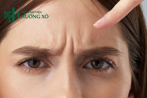 Địa Chỉ Xoá Nhăn Cau Mày Uy Tín Tại Hà Tĩnh