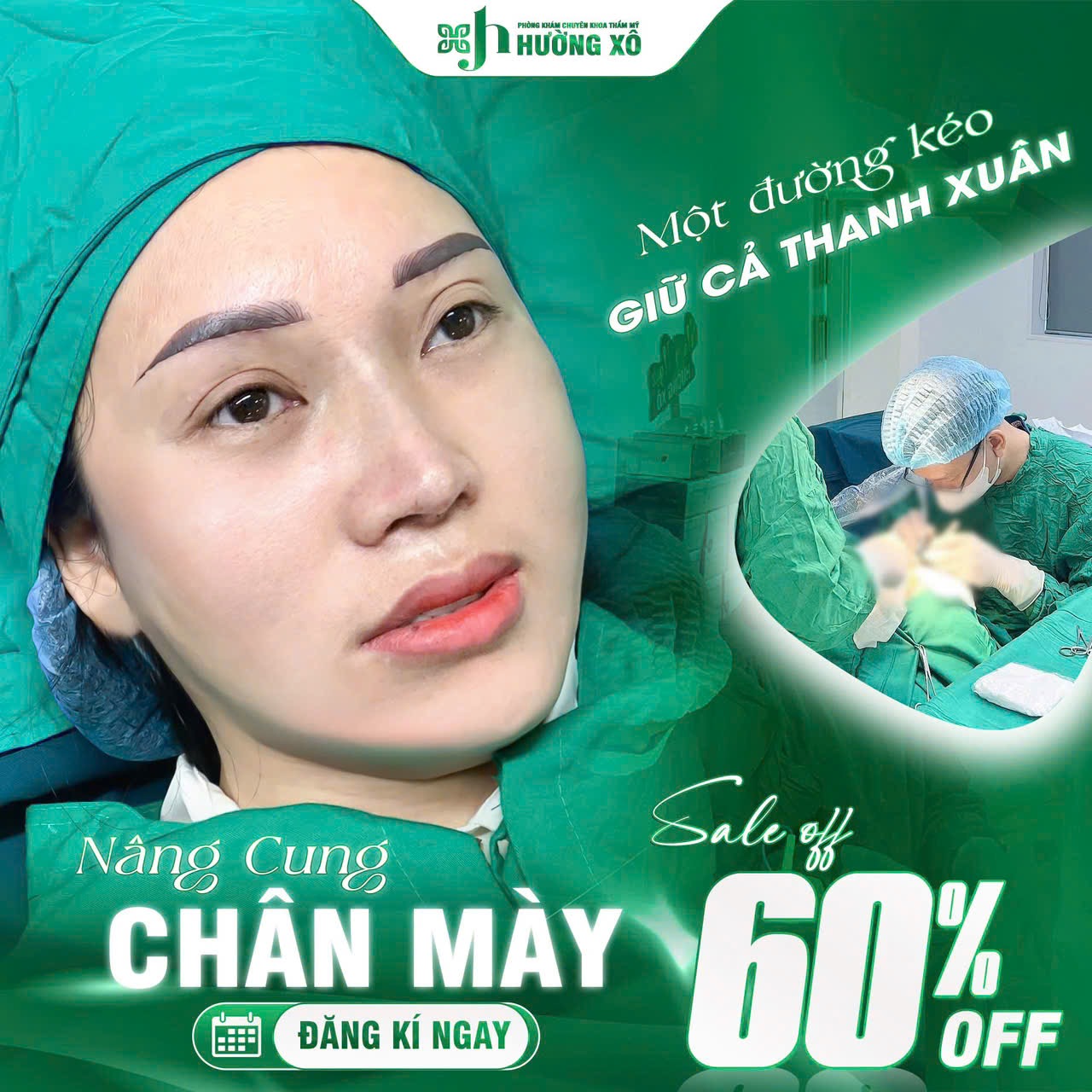 Dịch Vụ Nâng Cung Chân Mày Uy Tín Tại Hà Tĩnh