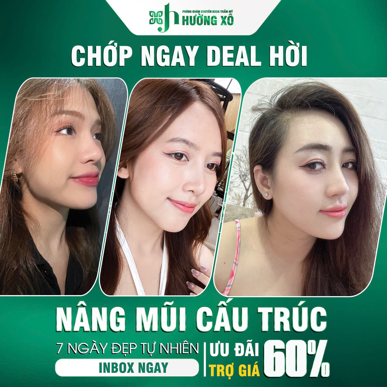 Tận Hưởng Dịch Vụ Nâng Mũi Cấu Trúc Tại Vinh, Nghệ An