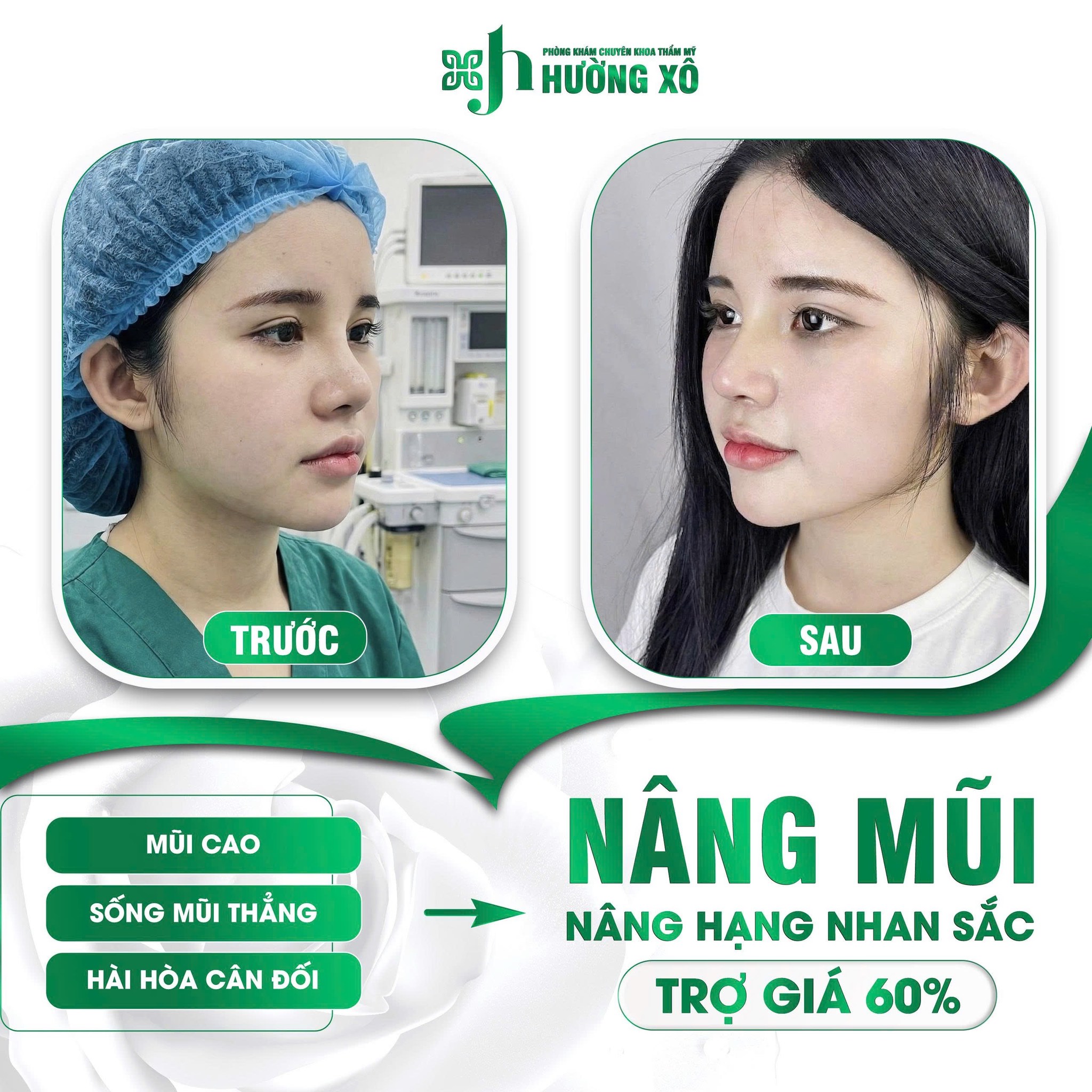 Trung Tâm Nâng Mũi Bán Cấu Trúc Uy Tín Tại Vinh, Nghệ An