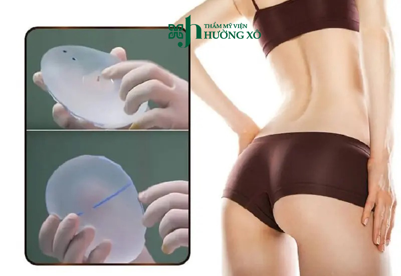 Địa Chỉ Độn Mông Uy Tín Tại Hà Tĩnh