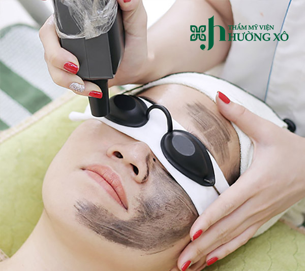 Địa Chỉ Trẻ Hoá Da Bằng Carbon Hoạt Tính Tại Hà Tĩnh