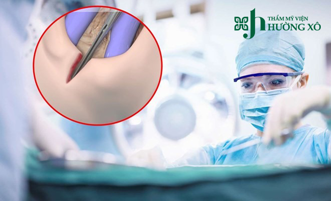 Phẫu Thuật Thẩm Mỹ Vùng Kín Uy Tín Tại Nghệ An