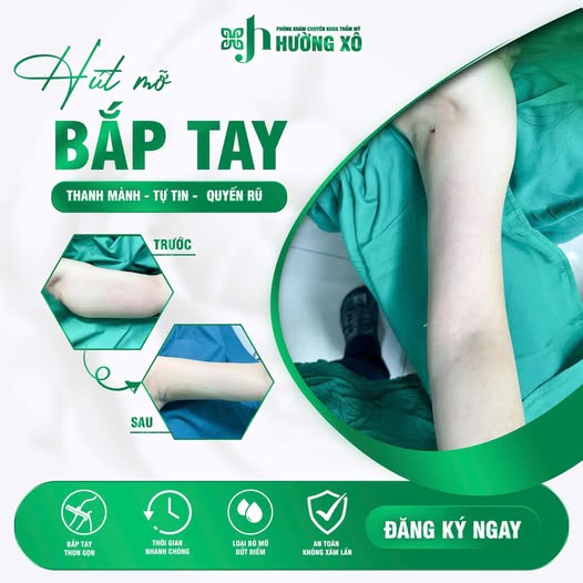 Địa Chỉ Hút Mỡ Bắp Tay Uy Tín Tại Nghệ An