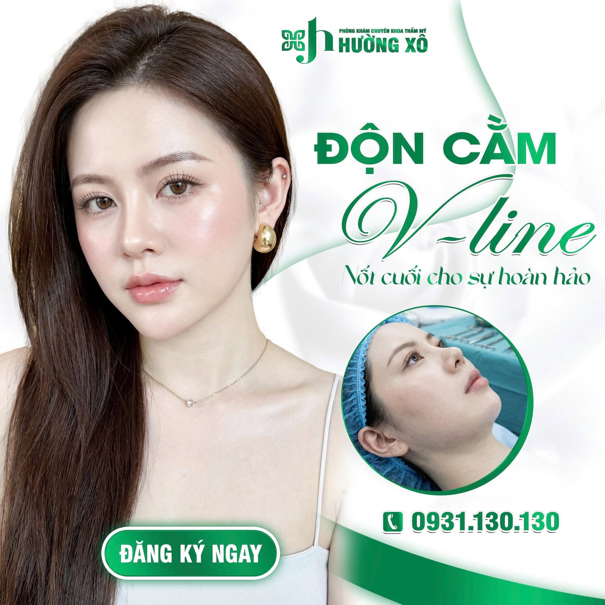 Độn Cằm V-Line Uy Tín Tại Hà Tĩnh