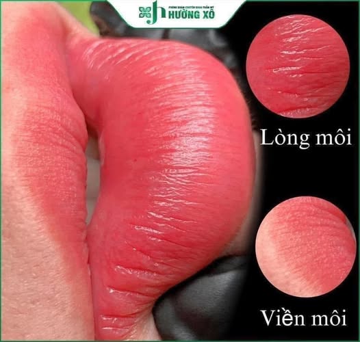Dịch Vụ Phun Môi Uy Tín Tại Nghệ An