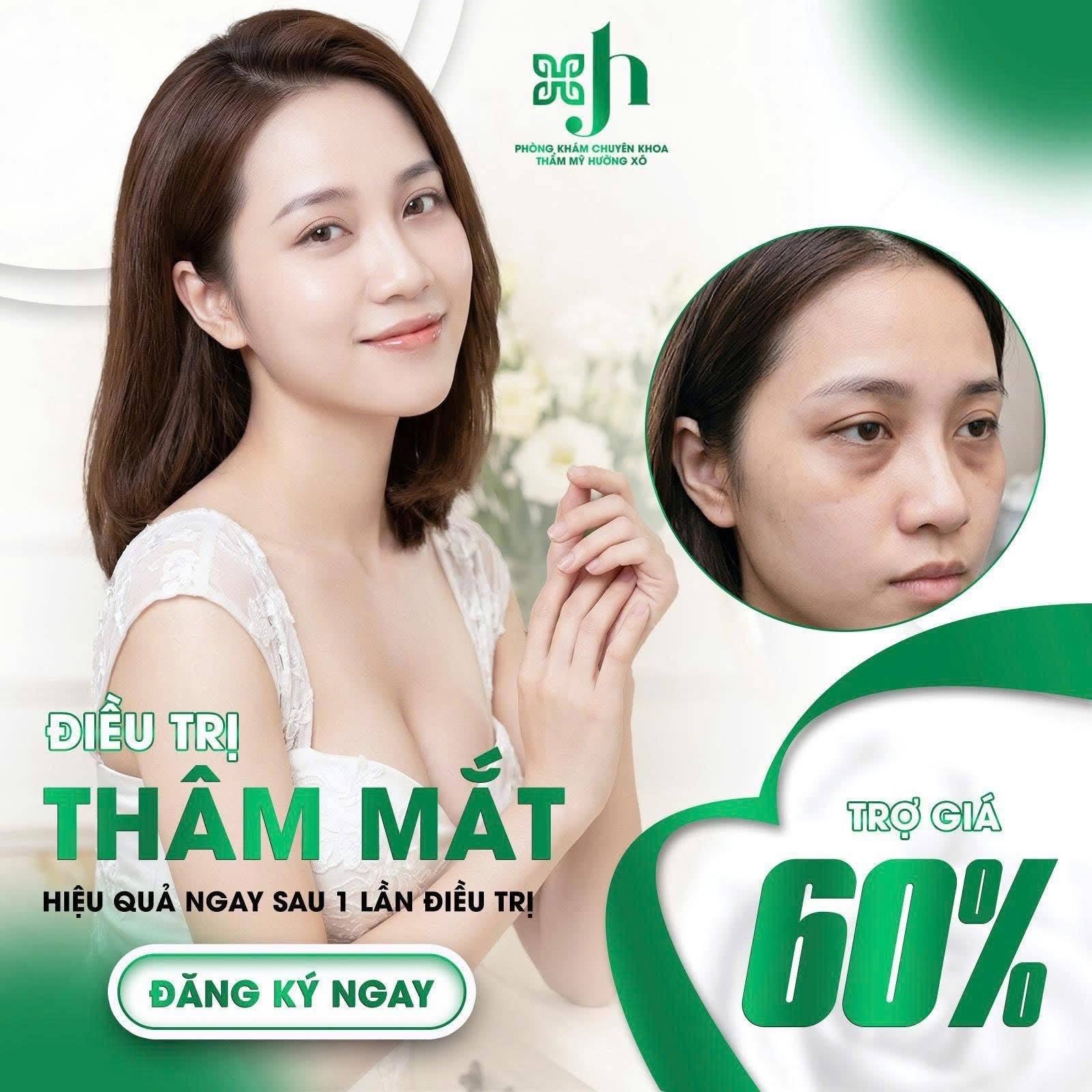 Địa Chỉ Điều Trị Thâm Mắt Tại Nghệ An