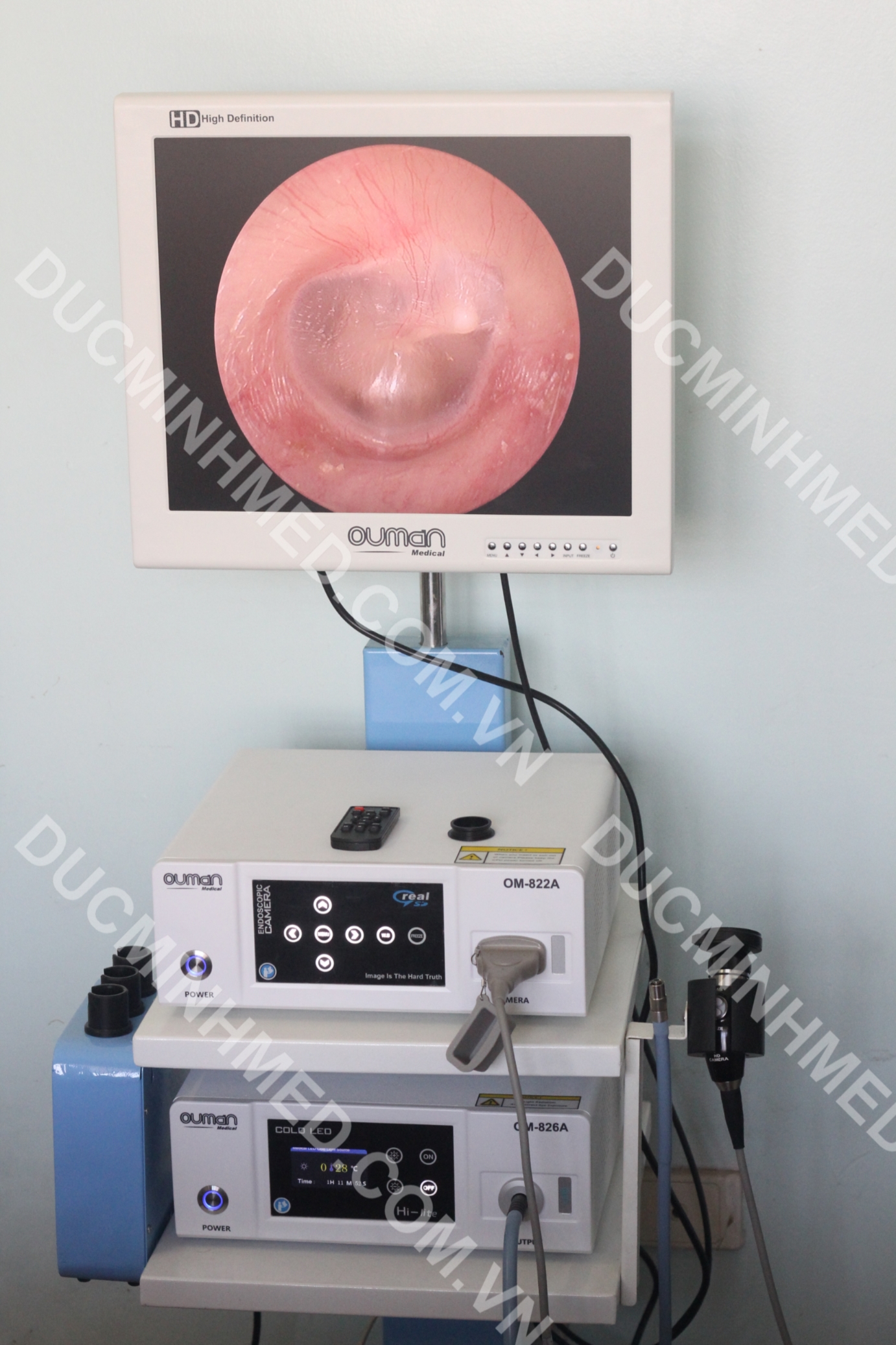 MÁY NỘI SOI TAI MŨI HỌNG OUMAN (MODEL: OM-822A REAL SD)