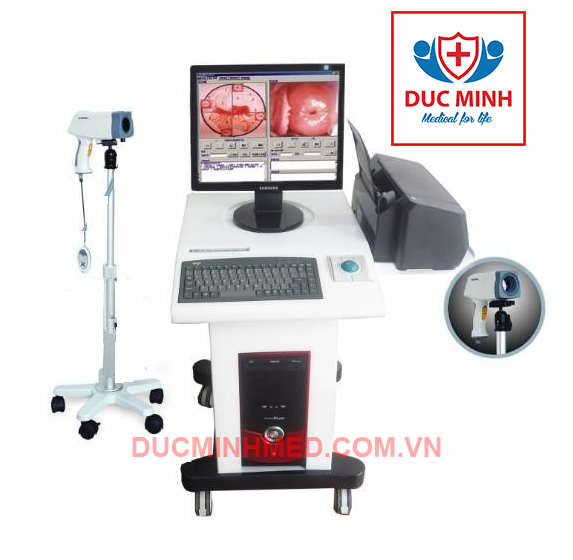 MÁY SOI CỔ TỬ CUNG KỸ THUẬT SỐ(Model: Sony Colposcope CCD Color Sony)