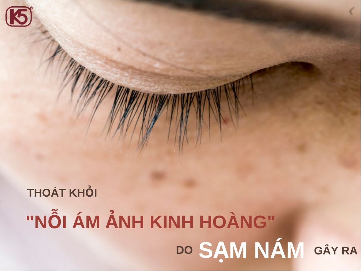 THOÁT KHỎI “NỖI ÁM ẢNH KINH HOÀNG” DO SẠM NÁM GÂY RA