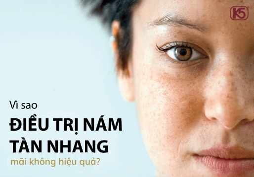 TẠI SAO BẠN TRỊ NÁM DA MÃI MÀ KHÔNG CÓ HIỆU QUẢ?