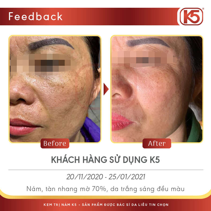 Feedback Khách Hàng Đến Từ Phương Vân Beauty Clinic