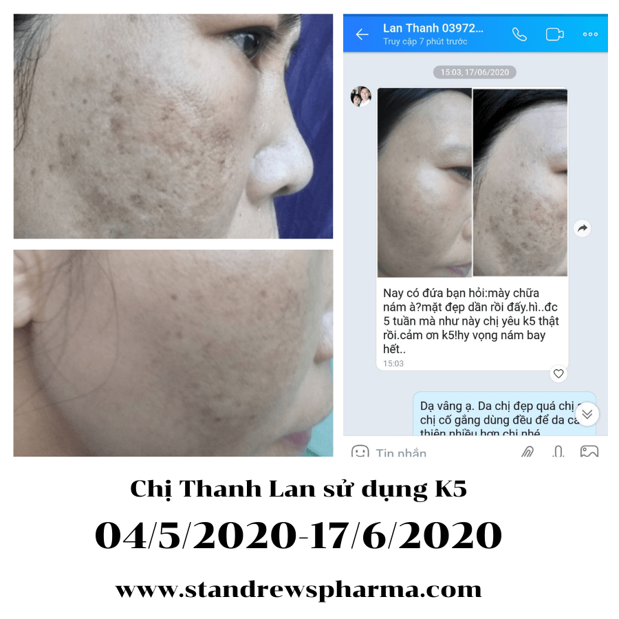 Không Có Hoàn Cảnh Nào Tuyệt Vọng Chỉ Có Người Tuyệt Vọng Vì Hoàn Cảnh