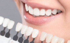 Thẩm mỹ răng sứ Bio Invio 3I
