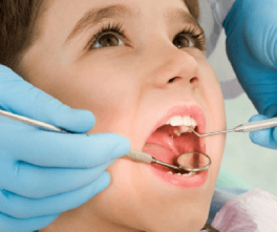 Những lợi ích của IMPLANT nha khoa