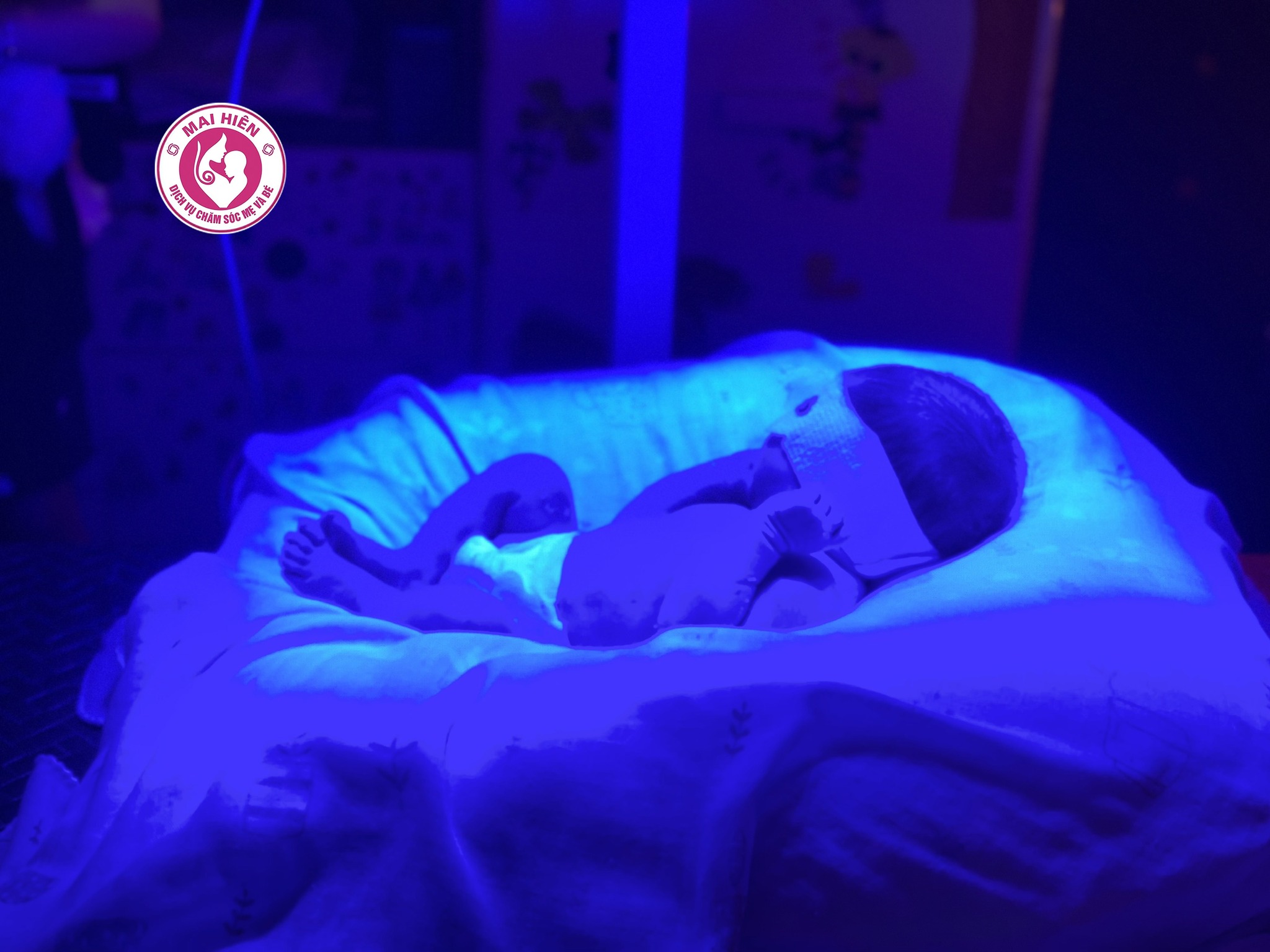 Chiếu đèn vàng da tại Nghệ An