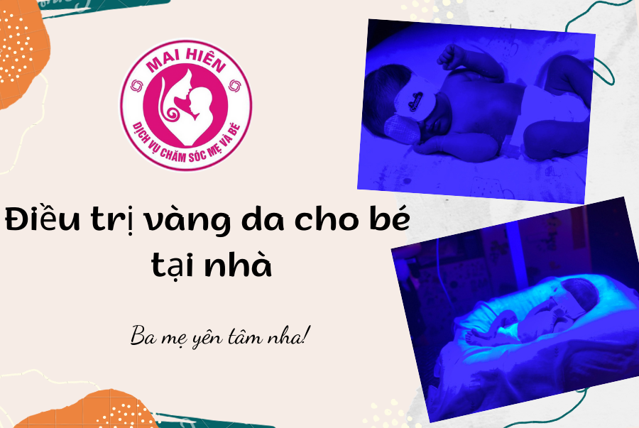 chiếu đèn vàng da tại Vinh