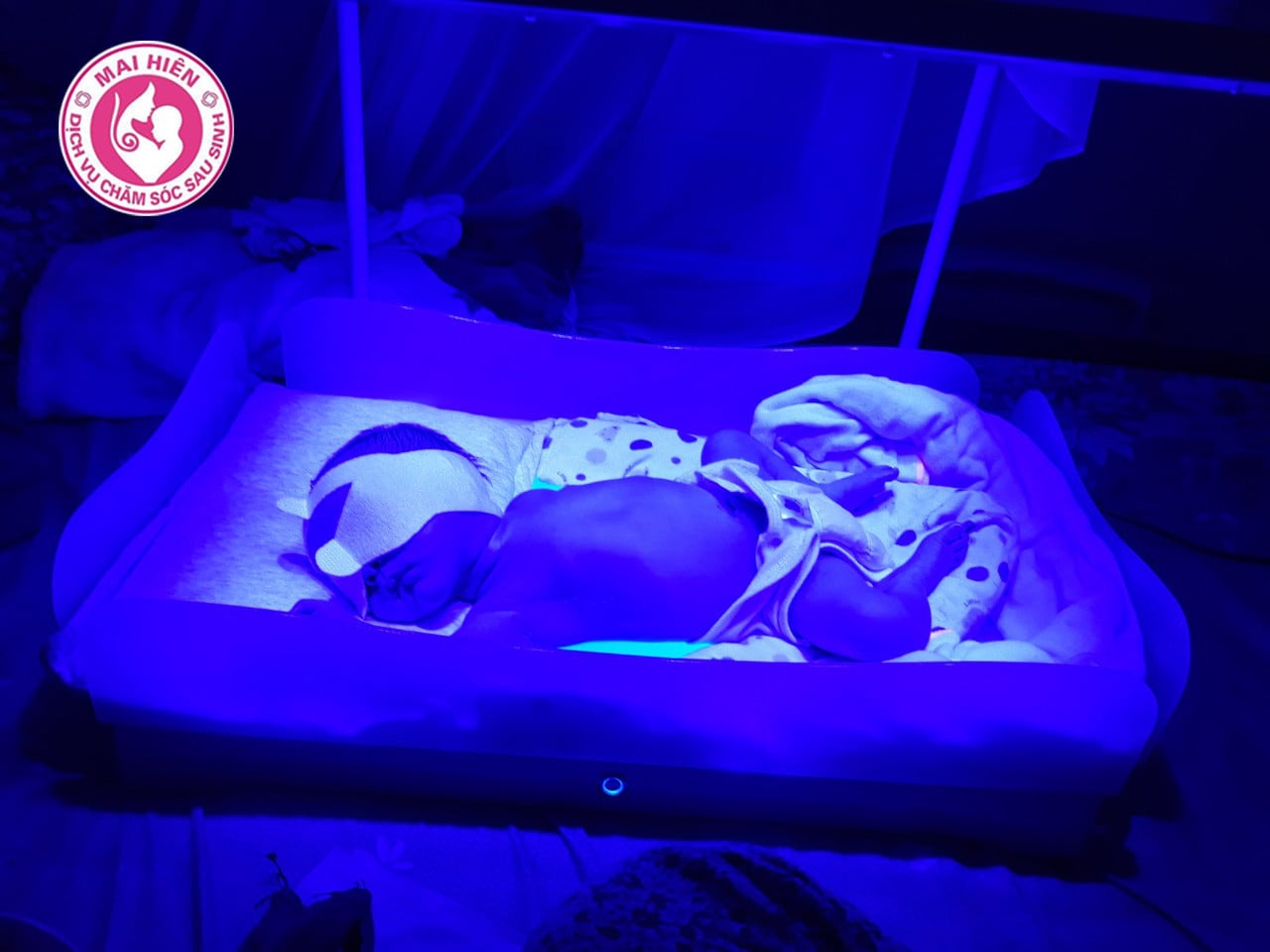 Chiếu đèn vàng da uy tín tại Vinh