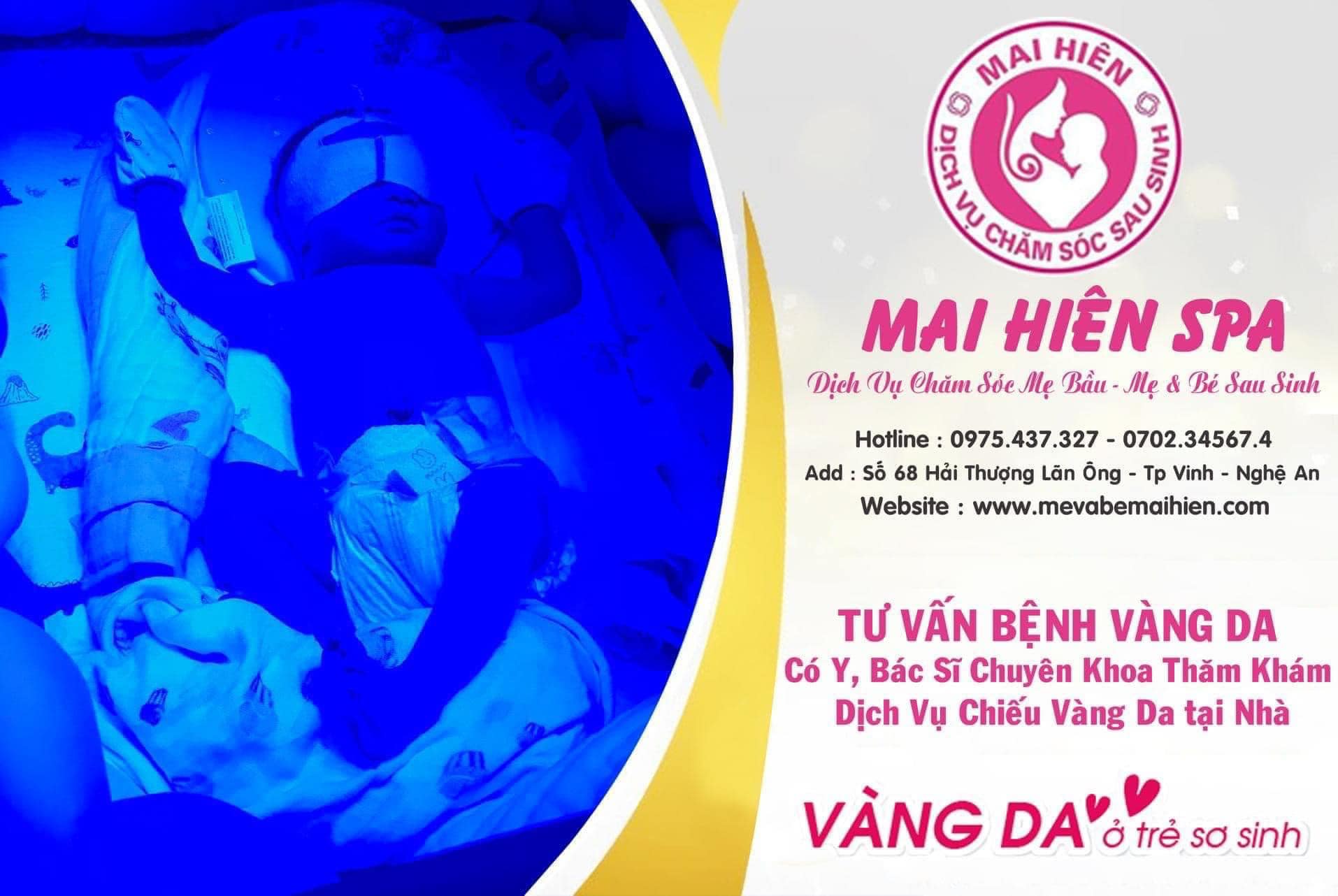 Chiếu đèn vàng da tại Nghệ An