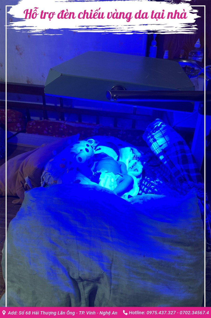 Chiếu đèn vàng da tại Vinh