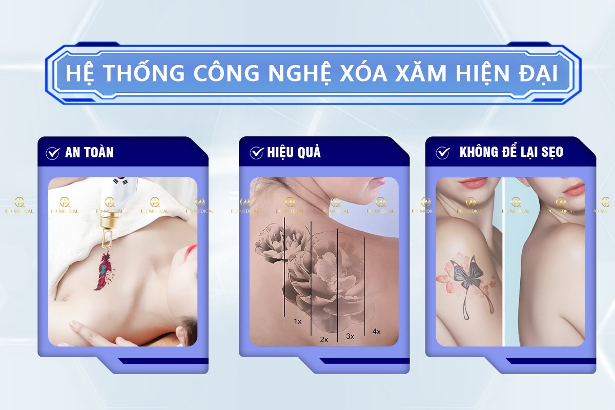 may triet long xoa xam 2in1