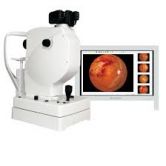 Máy ảnh đáy mắt Fundus SK- 650A/B