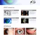 LS-8C Didital Slit Lamp