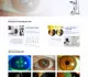 LS-34 Slit Lamp