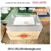 Lavabo âm bàn đá  KAG-LB765