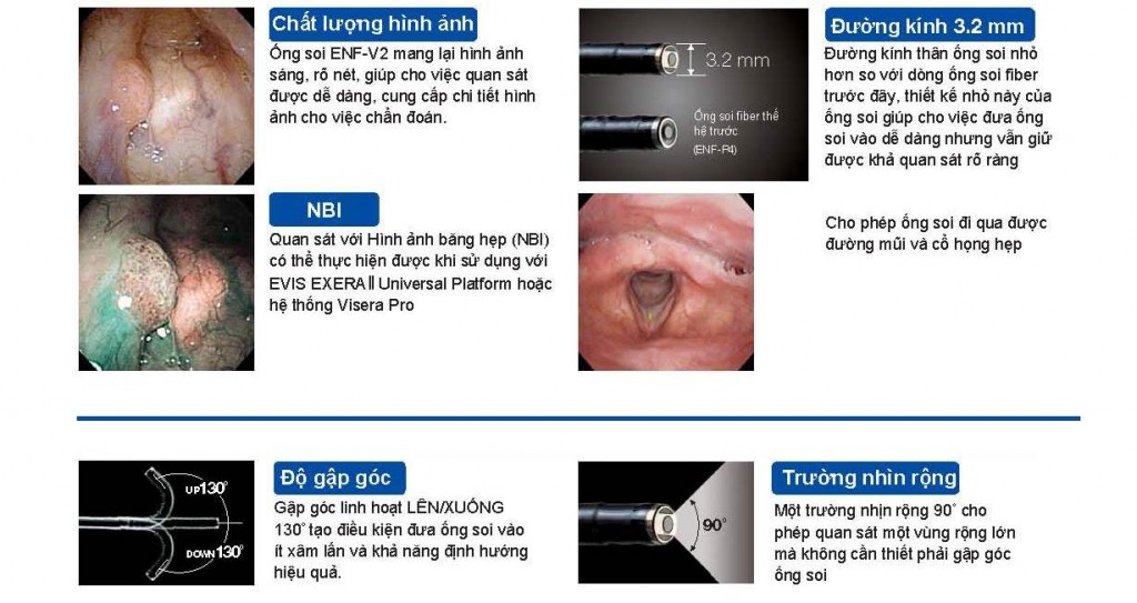 Tác dụng của máy nội soi tai mũi họng ống mềm