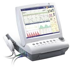 Monitor sản khoa