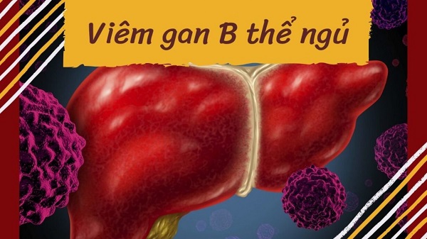 Viêm gan virus ở thể ngủ thì điều trị như thế nào?