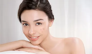 Trị sẹo