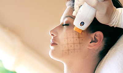 Trẻ hóa da hemage